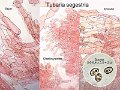 Tubaria segestria-amf5-micro